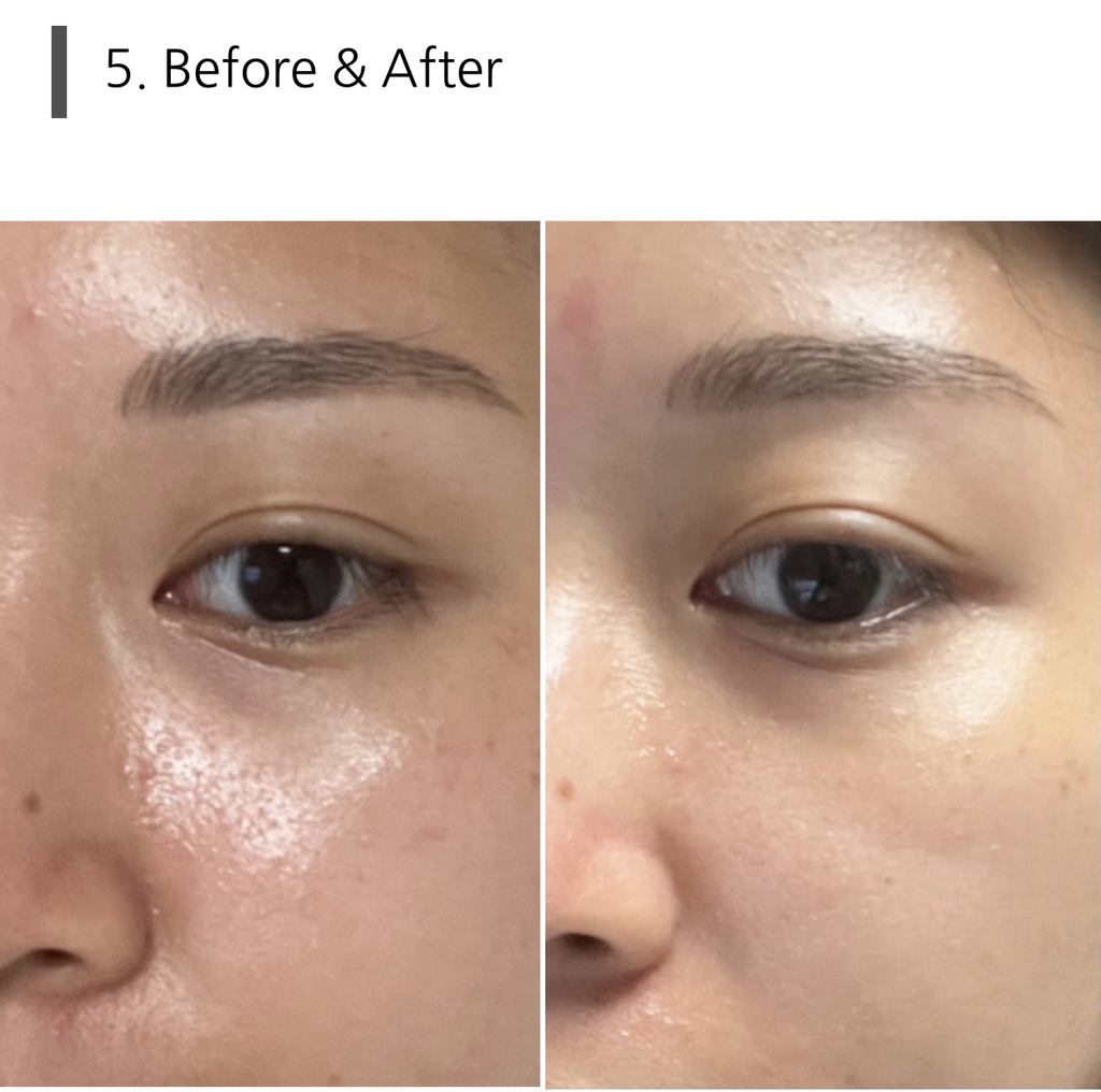 리쥬란코스메틱 (REJURANCOSMETICS) 더마 힐러 포어 타이트닝 앰플 review image