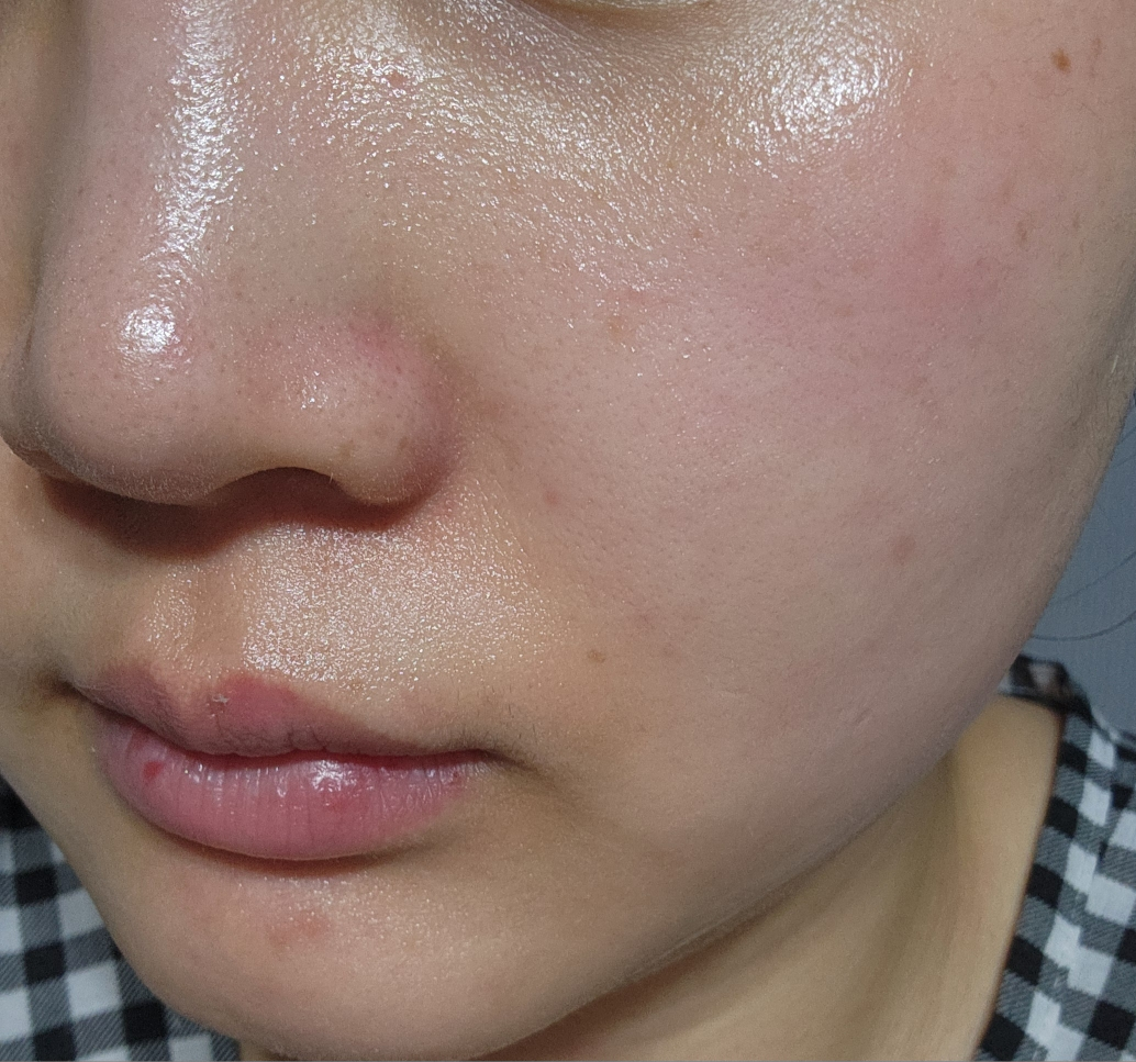 MediAnswer 胶原蛋白纳米喷雾面膜[维他] common.review image