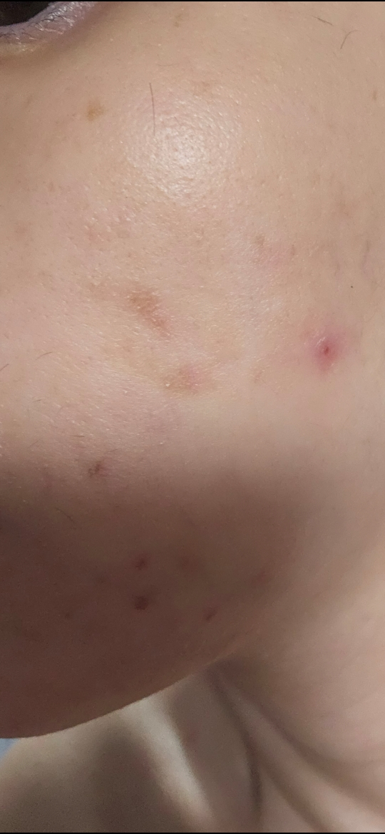 MEDIPEEL 皮托西卡诺尔B5镇静植物性面膜 common.review image