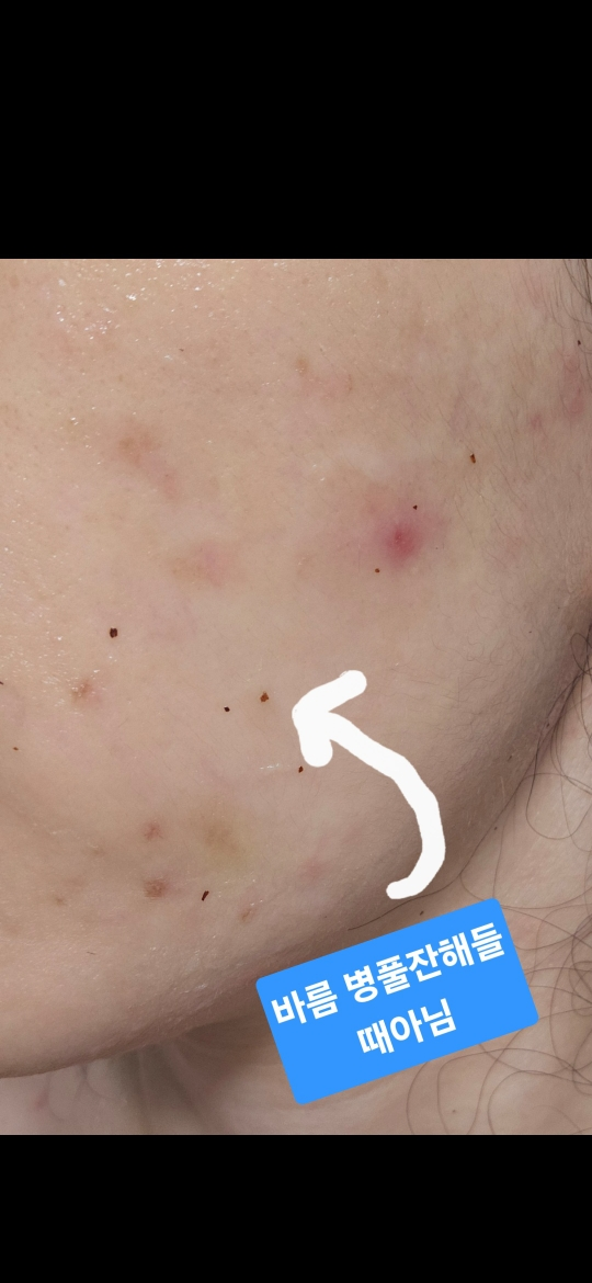 MEDIPEEL 皮托西卡诺尔B5镇静植物性面膜 common.review image