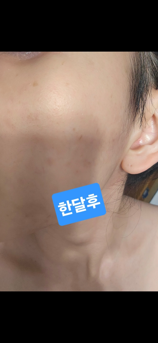 메디필 (MEDIPEEL) 피토 시카놀 B5 카밍 비건 랩핑 마스크 review image