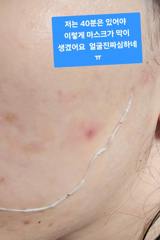 메디필 (MEDIPEEL) 피토 시카놀 B5 카밍 비건 랩핑 마스크 review image