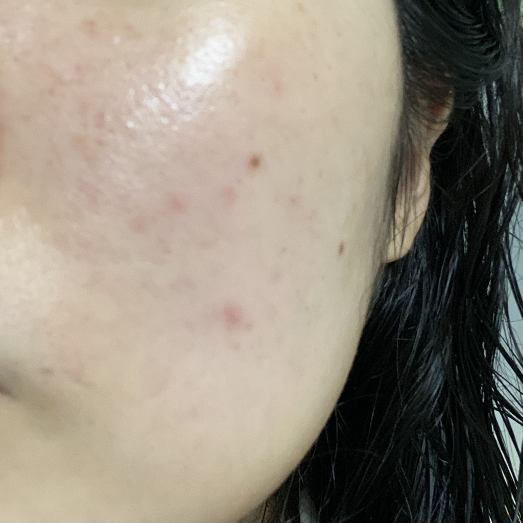 平衡肌肤舒缓控油精华的真实用户使用照片