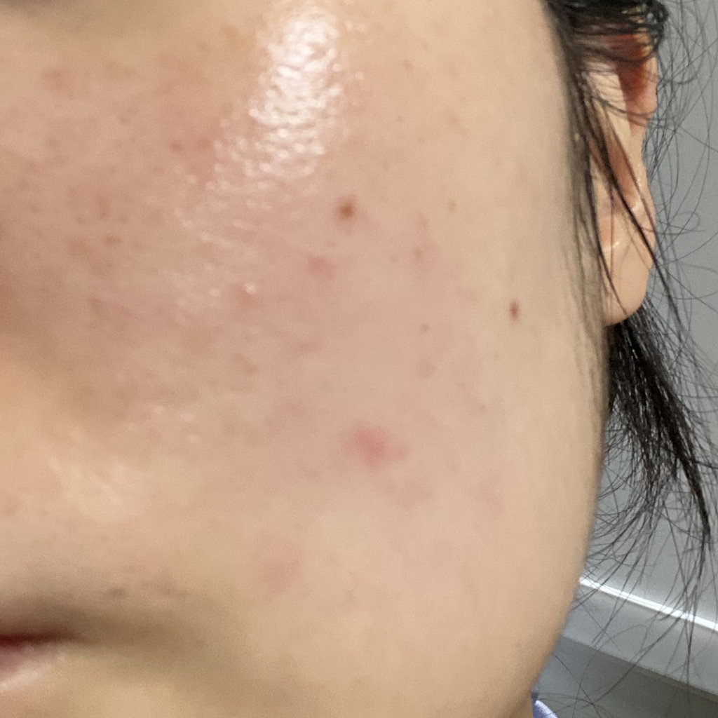 平衡肌肤舒缓控油精华的真实用户使用照片