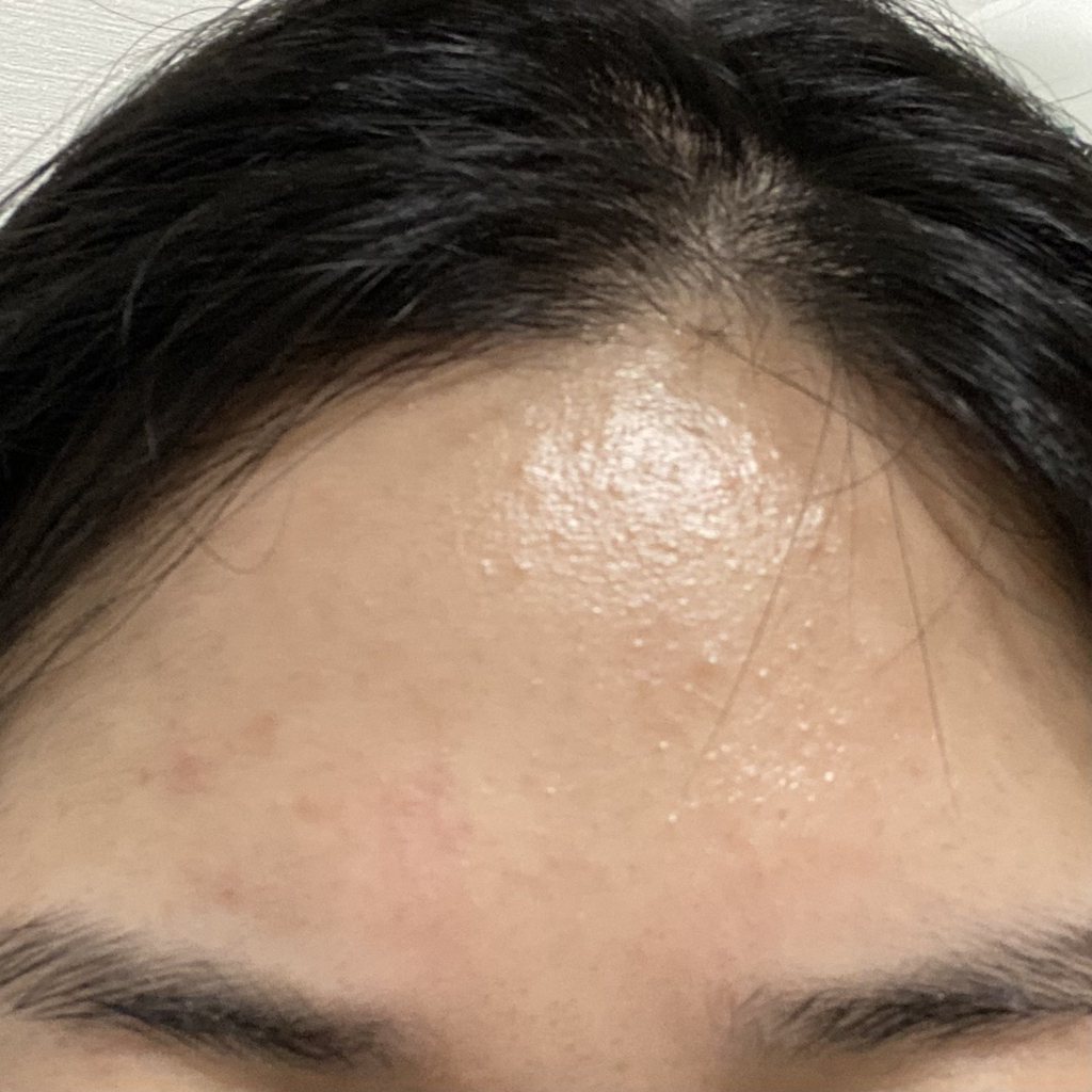 平衡肌肤舒缓控油精华的真实用户使用照片