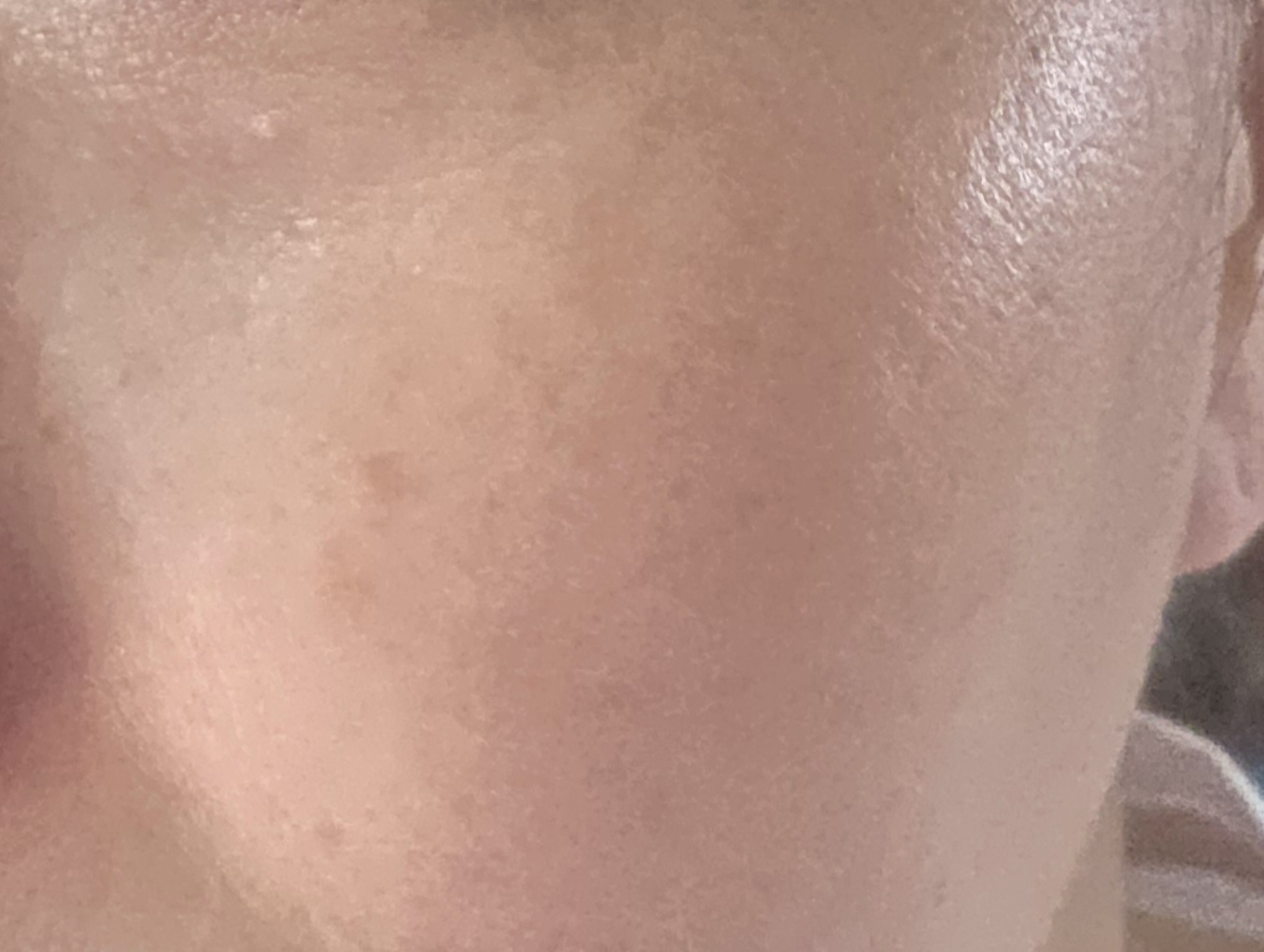 保湿医生乳霜的真实用户使用照片