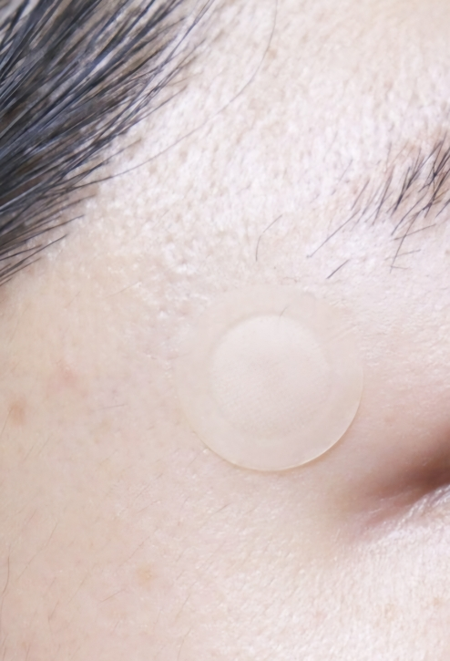 微针剂外泌体斑点贴片的真实用户使用照片