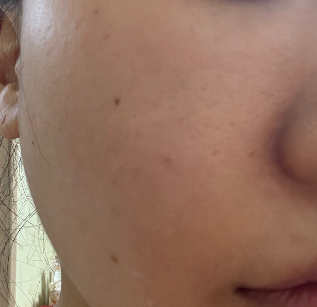施卡 PDRN 肌肤补充精华液的真实用户使用照片