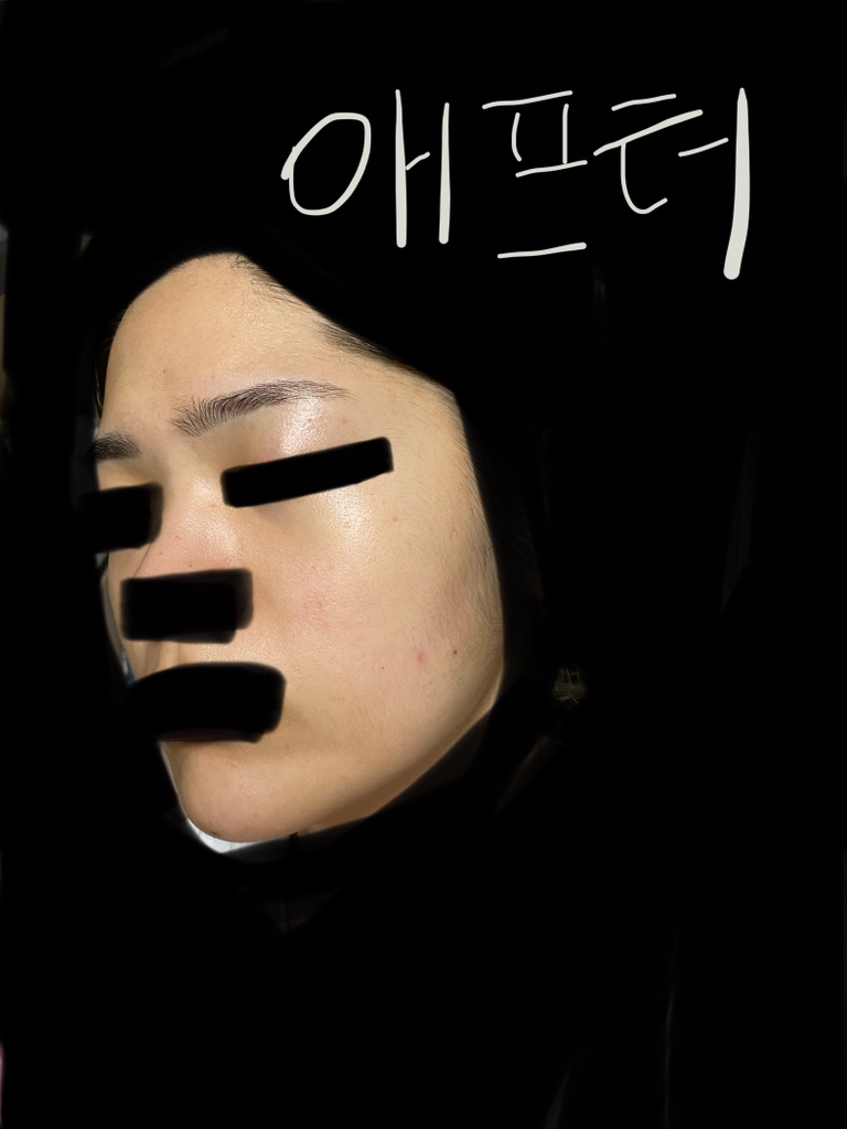 히디프 (hidiff) 로얄 레이어링 버블토너 review image