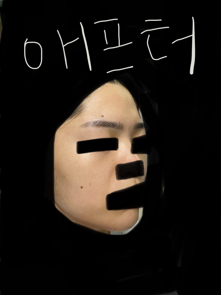 히디프 (hidiff) 로얄 레이어링 버블토너 review image
