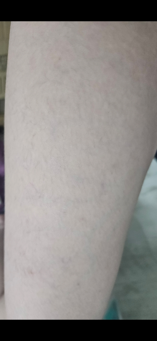 그린핑거 (GREENFINGER) 판테딘 엠디 더마 크림 review image