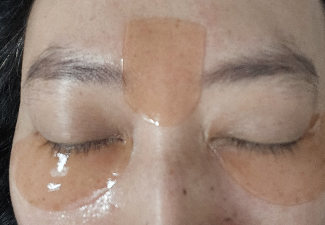 아이소이 (ISOI) 블레미쉬 케어 아이 앤 미간 패치 review image