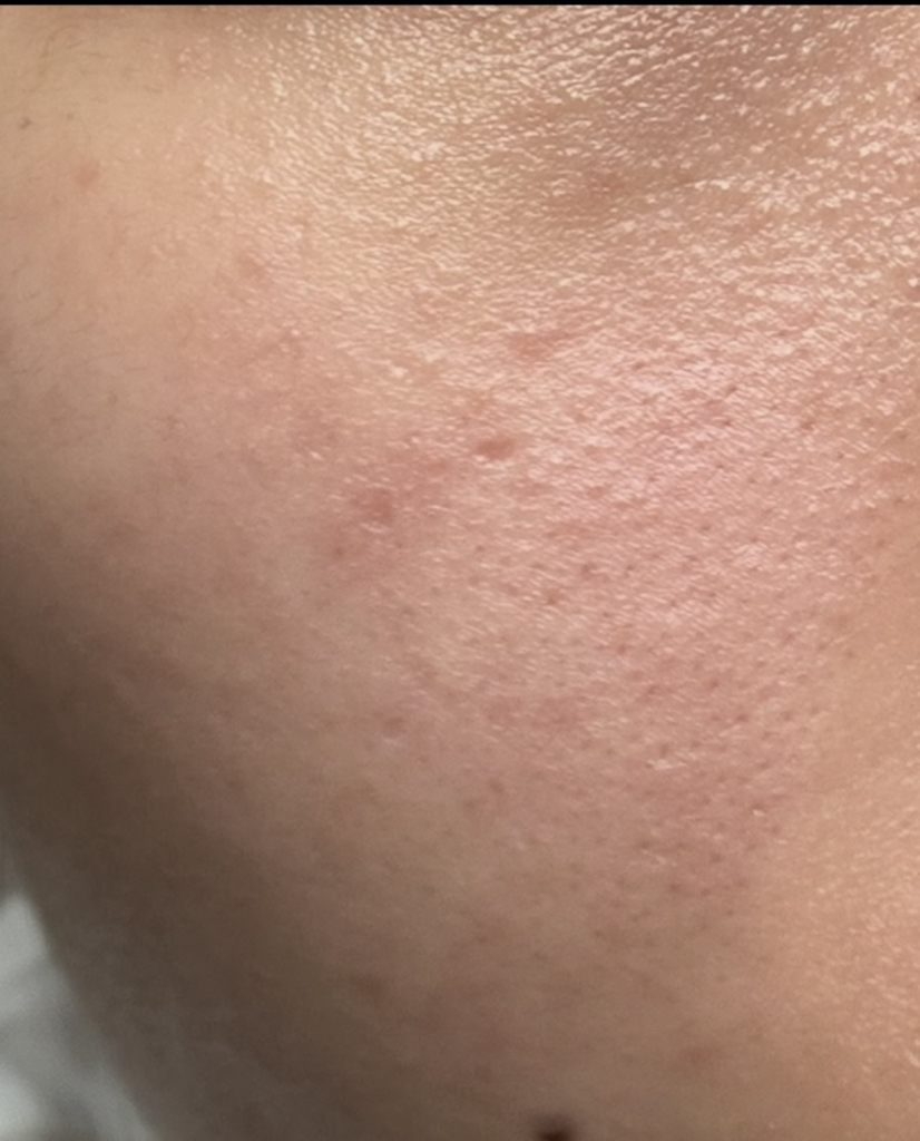 celimax 亮白毛孔祛斑化妆包 common.review image