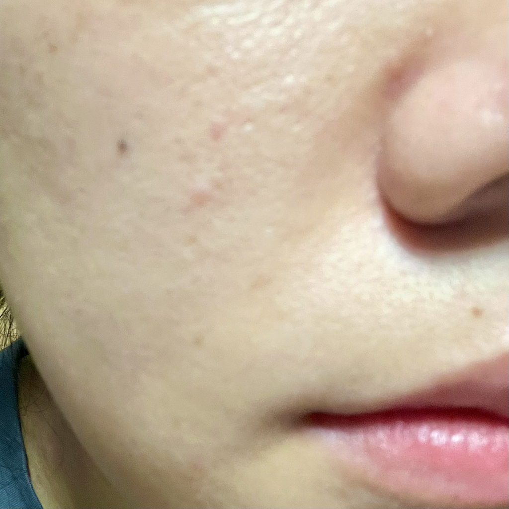 닥터상떼 (Dr.SANTE) 아줄렌 수더 겔 review image