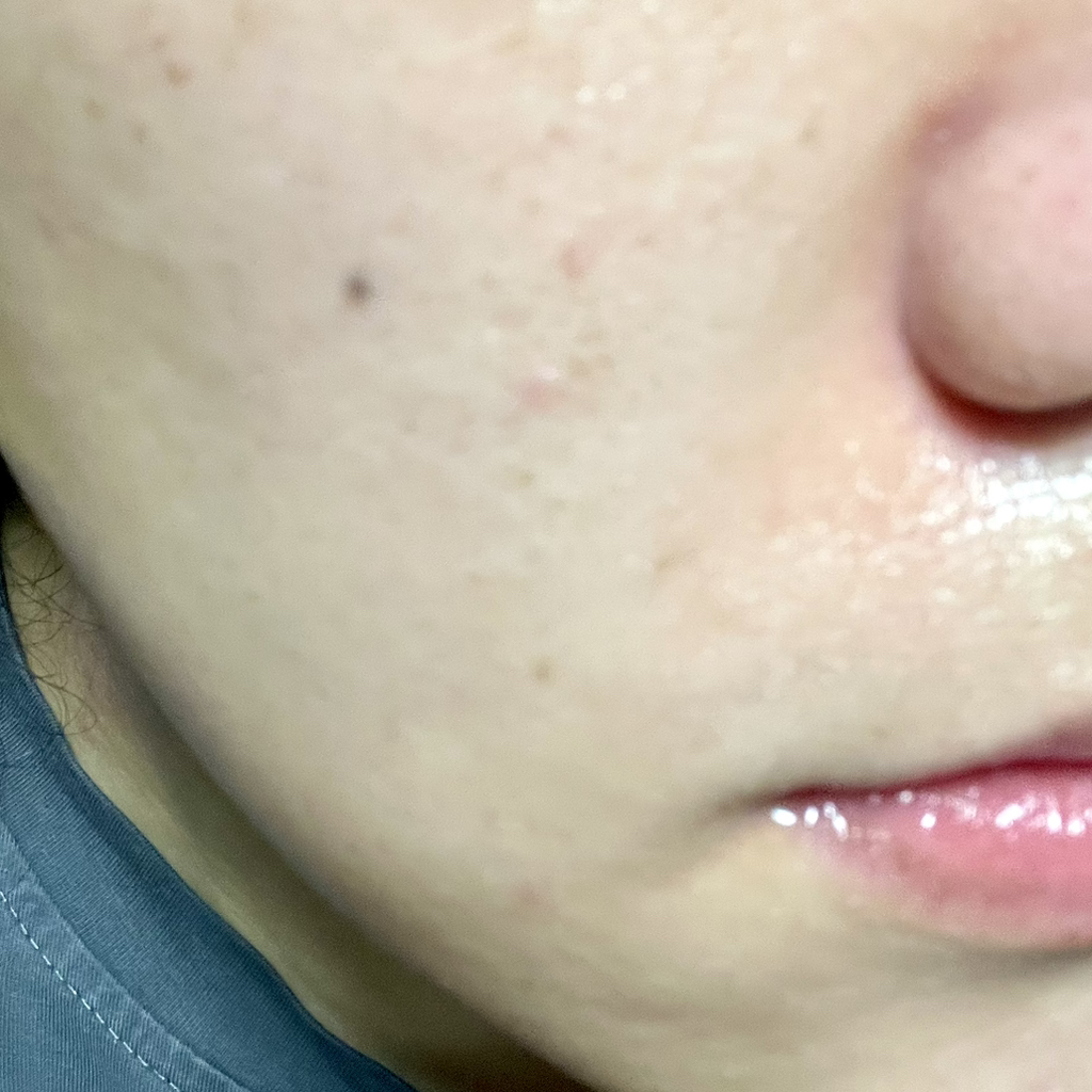 닥터상떼 (Dr.SANTE) 아줄렌 수더 겔 review image