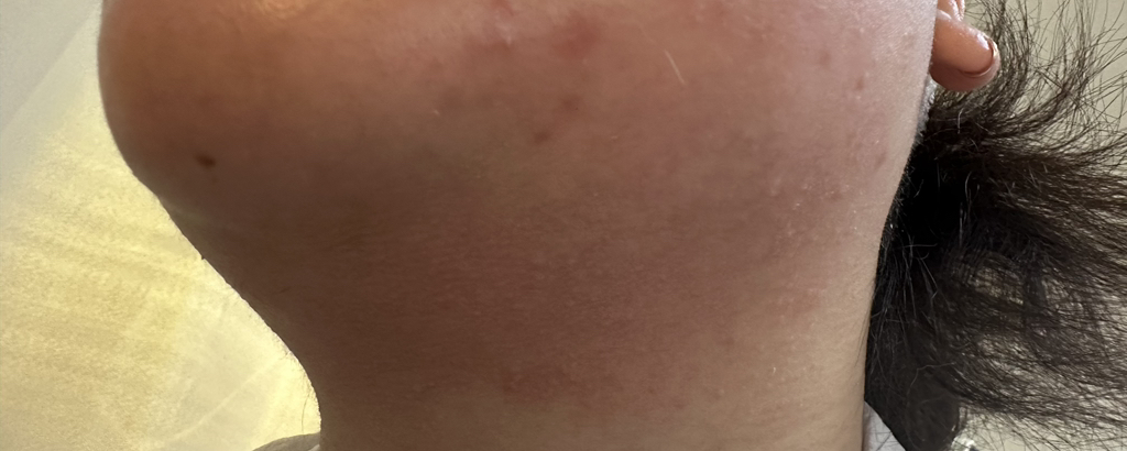 谷胱甘肽美白精华维他命滴剂的真实用户使用照片