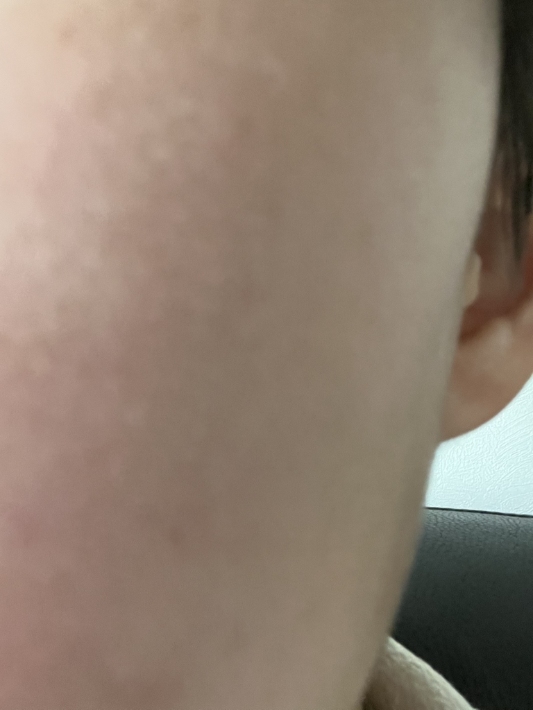 茶树精华舒缓爽肤垫的真实用户使用照片