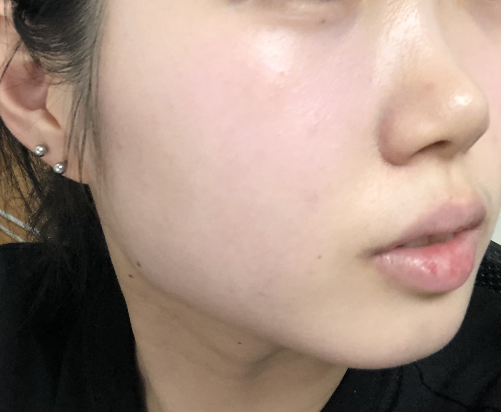 爱情光束脸颊炸弹 [02 #PureBeam]的真实用户使用照片