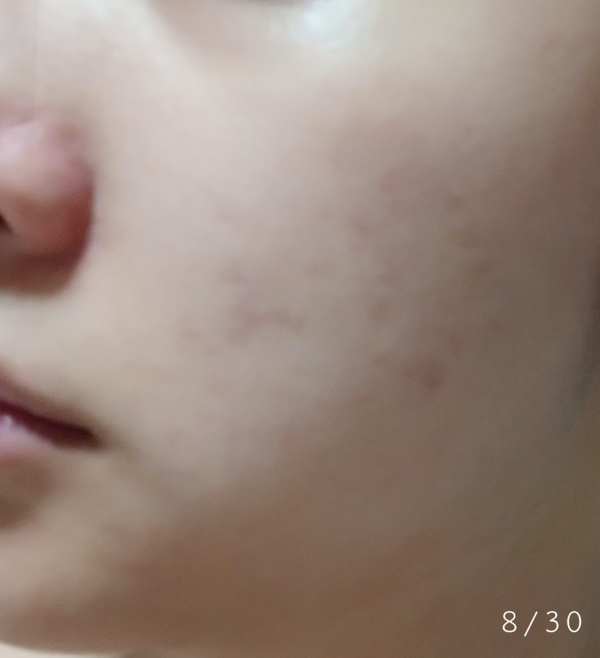 紫色洋葱修复霜的真实用户使用照片