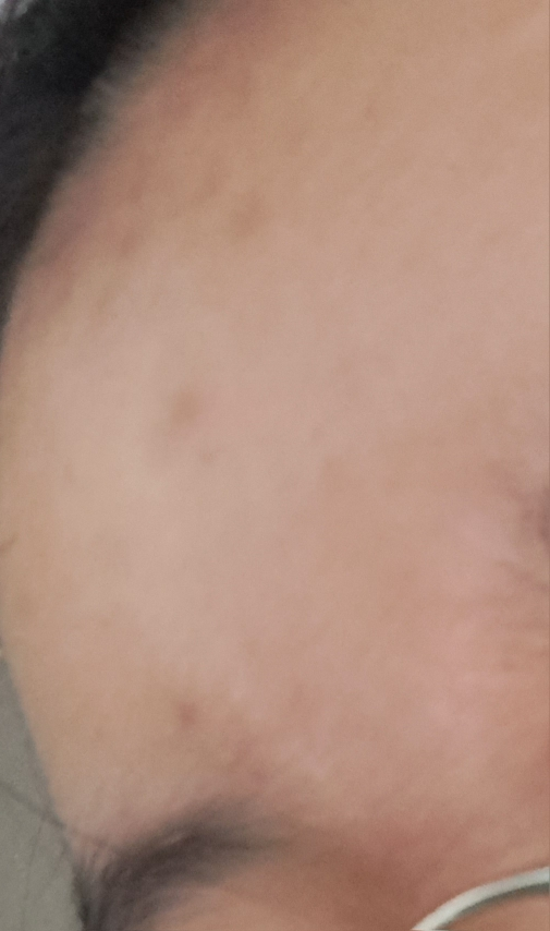 诺斯卡纳修复霜的真实用户使用照片