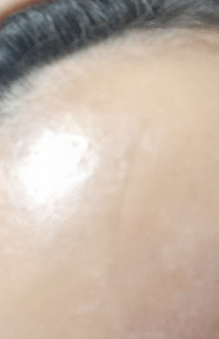 诺斯卡纳修复霜的真实用户使用照片