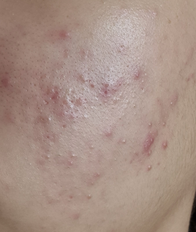 product review image