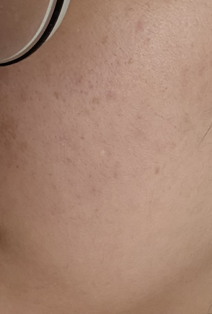 성분에디터 (SUNGBOONeditor) 포켓몬 콜라보 그린토마토 NMN 포어 리프팅 앰플 review image