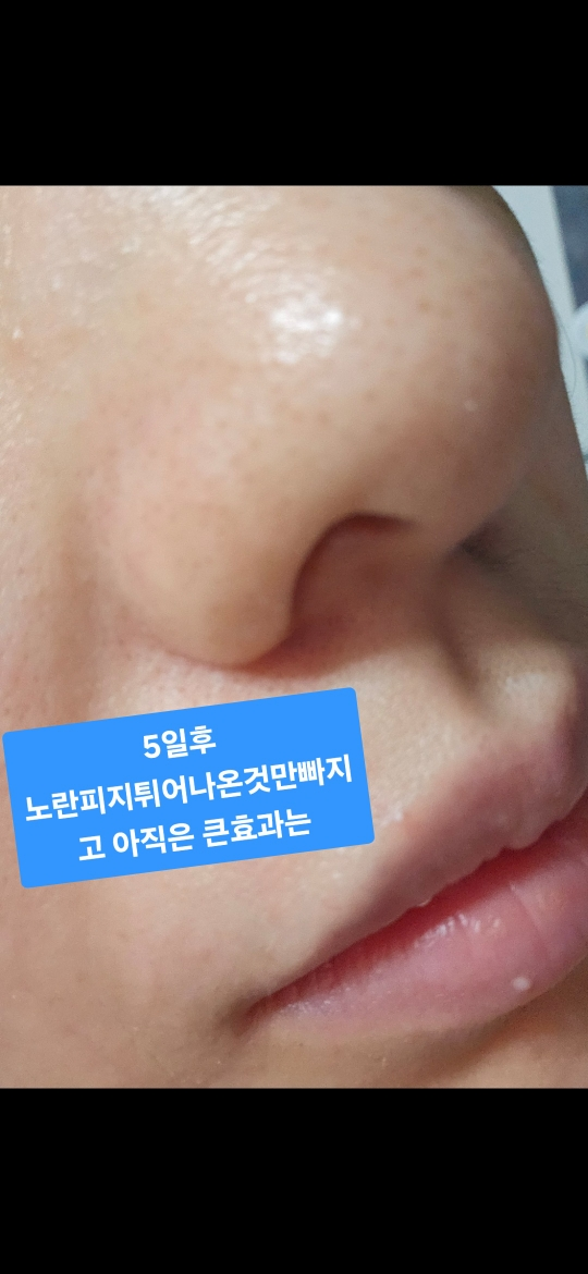 한스킨 (Hanskin) 클렌징오일&블랙헤드 [PHA] review image