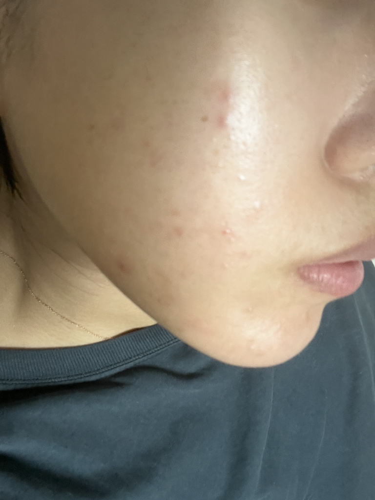 더마젼시 (DERMAGENCY) 제로카 86 토너 review image