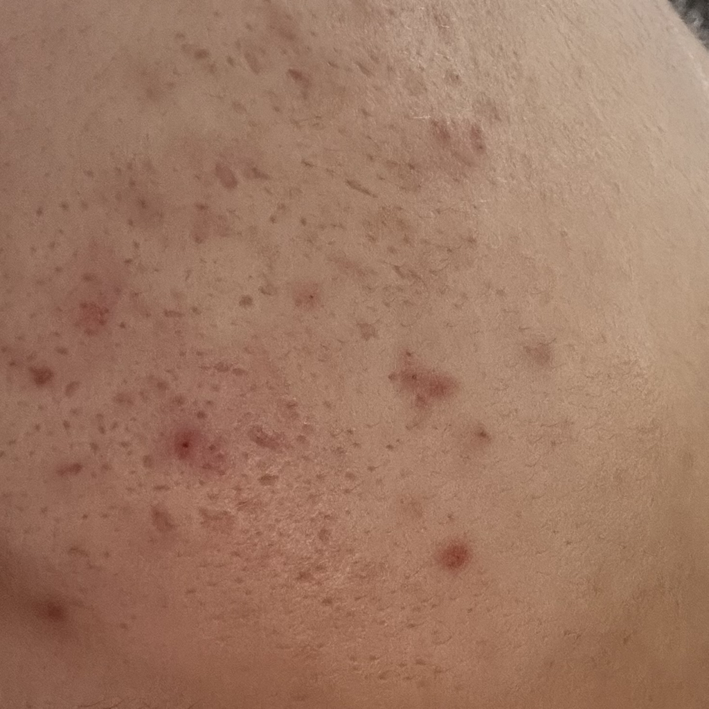 마미케어 (mommycare) 바다포도 모공앰플 review image