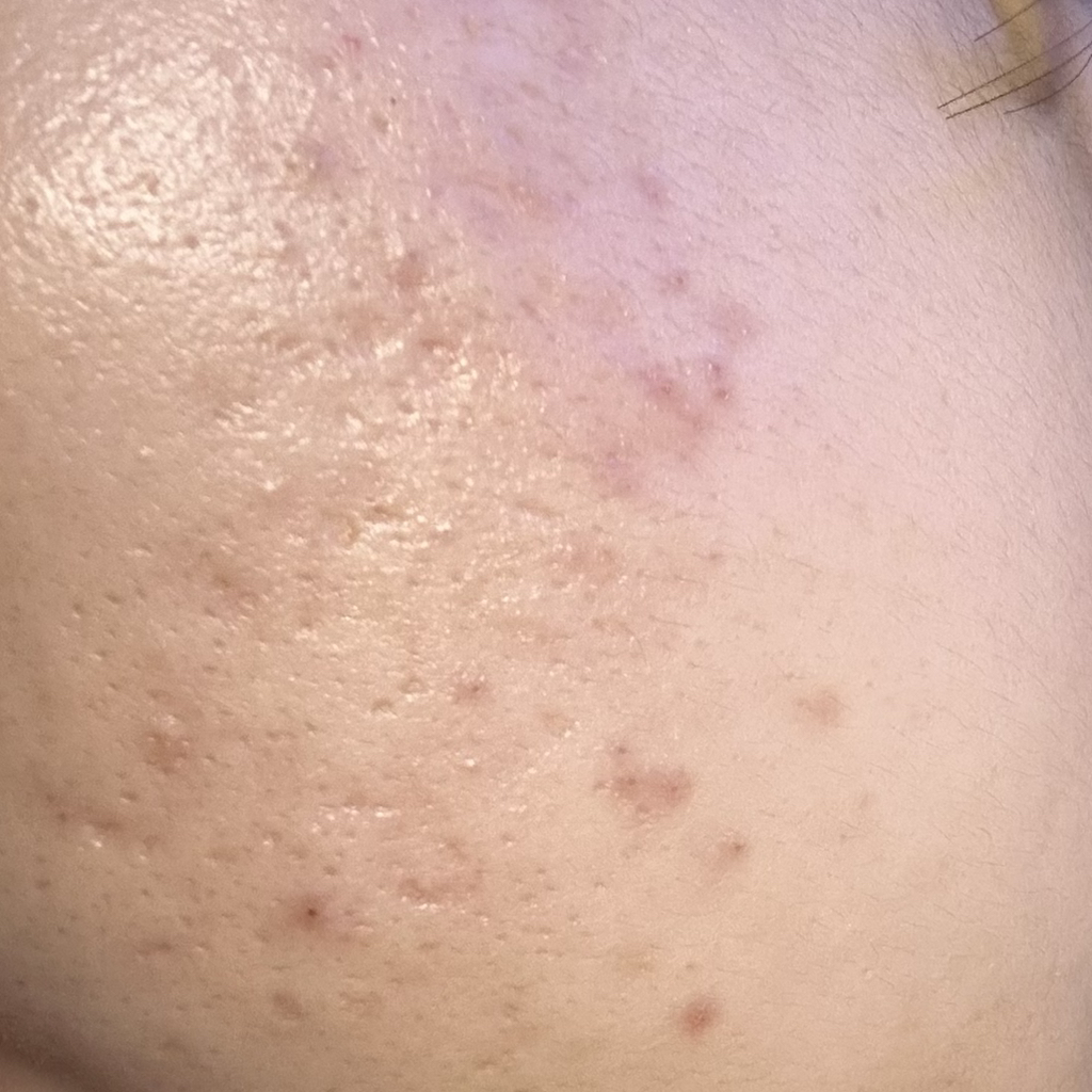 마미케어 (mommycare) 바다포도 모공앰플 review image