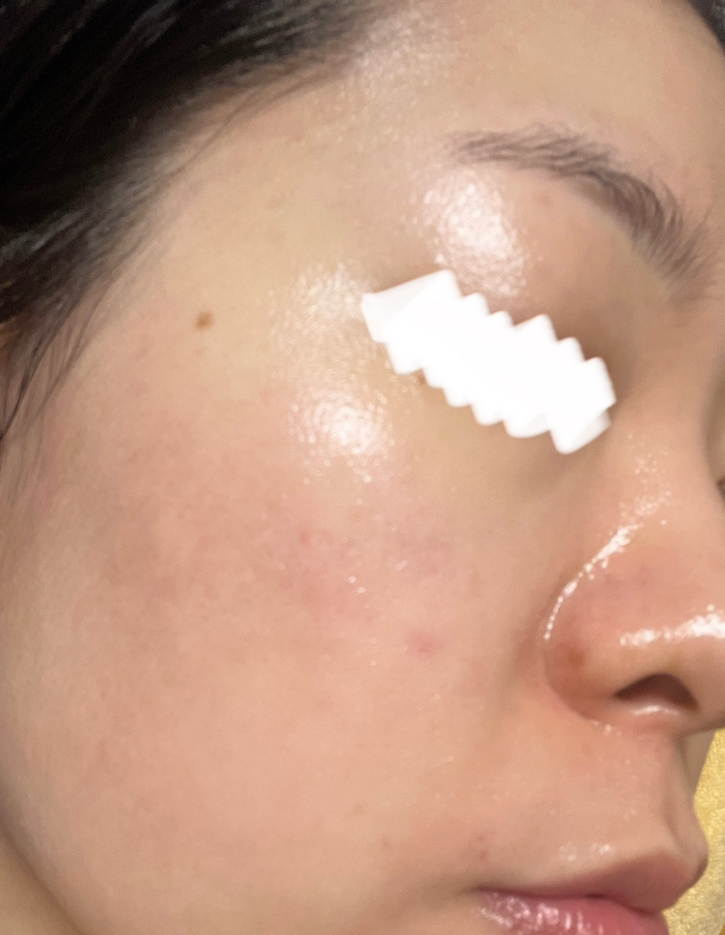 皮肤屏障迷彩乳液的真实用户使用照片