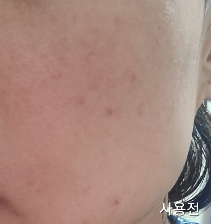 积雪草安瓶精华液的真实用户使用照片