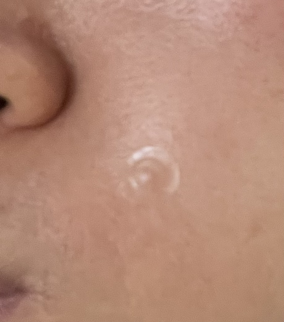 닥터오라클 (Dr.Oracle) 터핀아크™ 스팟패치 review image