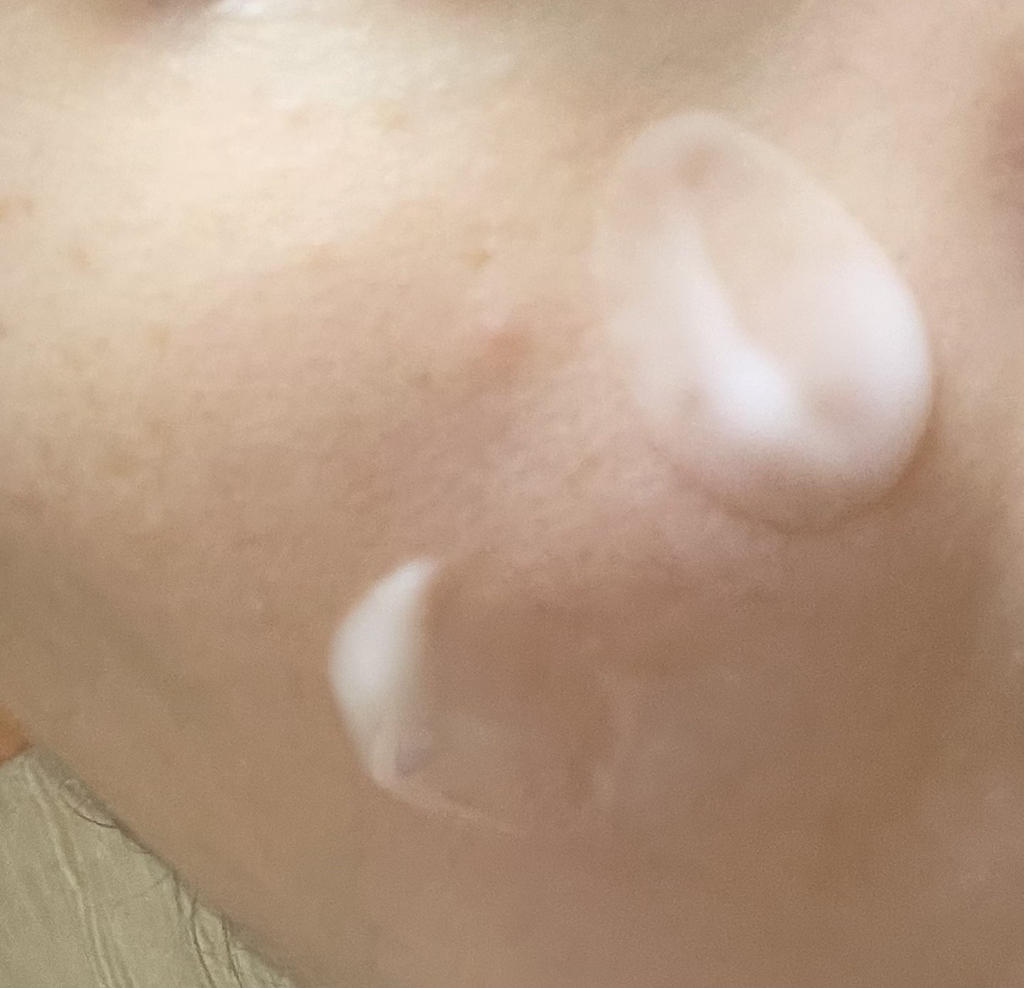 1025 独岛乳液的真实用户使用照片