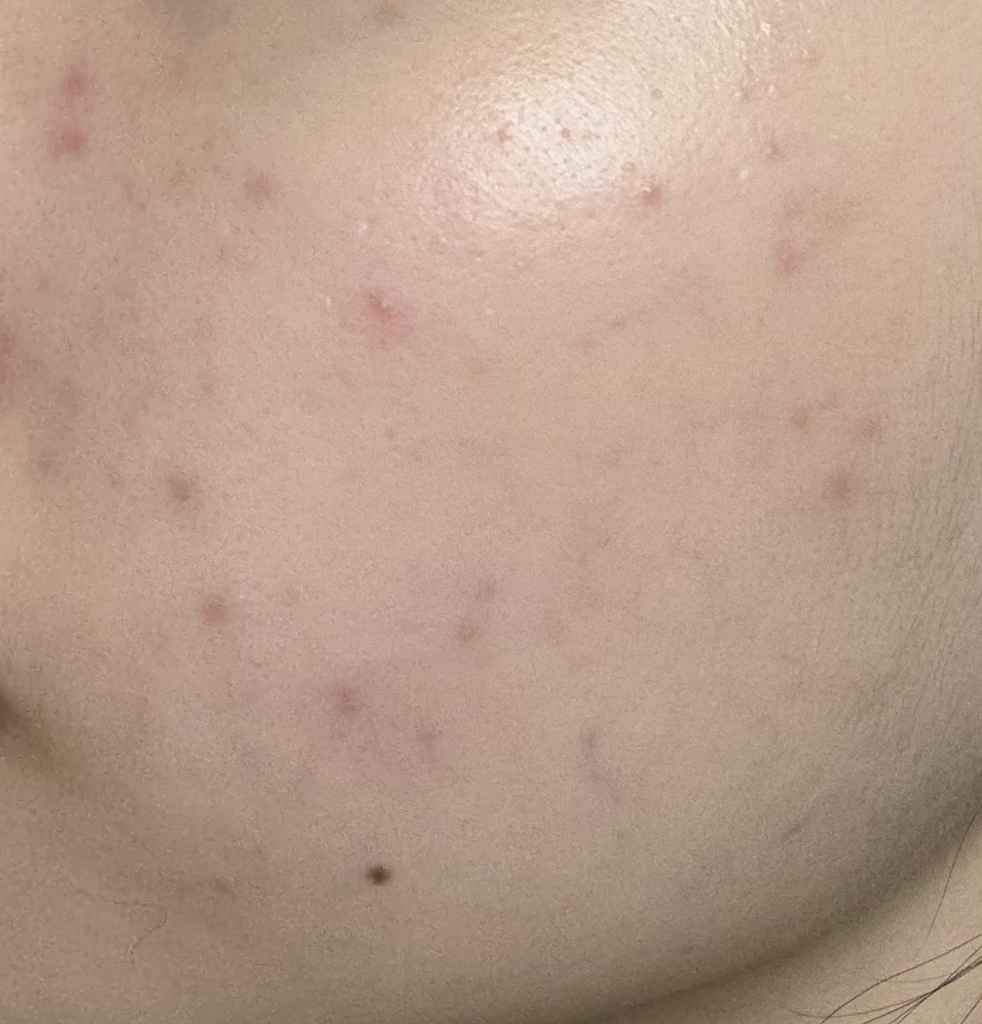 닥터브로너스 (DR.BRONNER'S) 퓨어 캐스틸 솝 [베이비마일드] review image