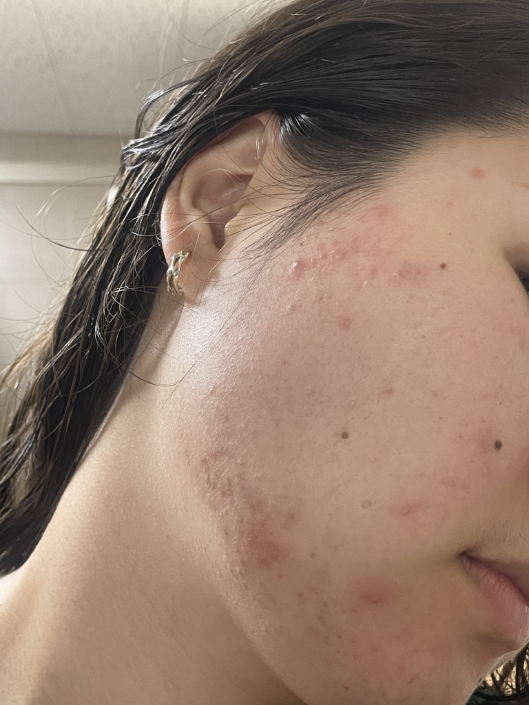 코스알엑스 (COSRX) 퓨어 핏 시카 세럼 review image