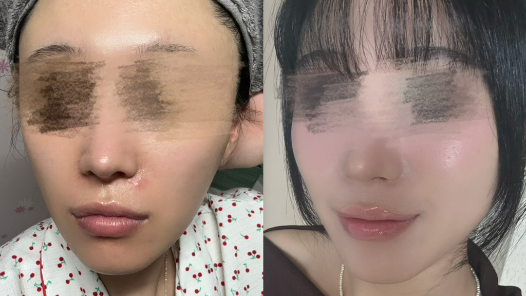 히디프 (hidiff) 로얄 소프트 클린키트 review image