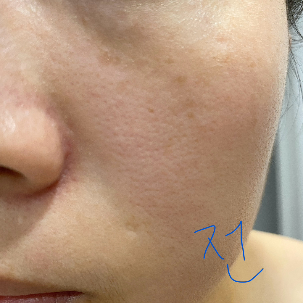 스킨앤랩 (SKIN&LAB) 쓰리디 피디알엔 엑스 콜라겐 랩핑 마스크 review image