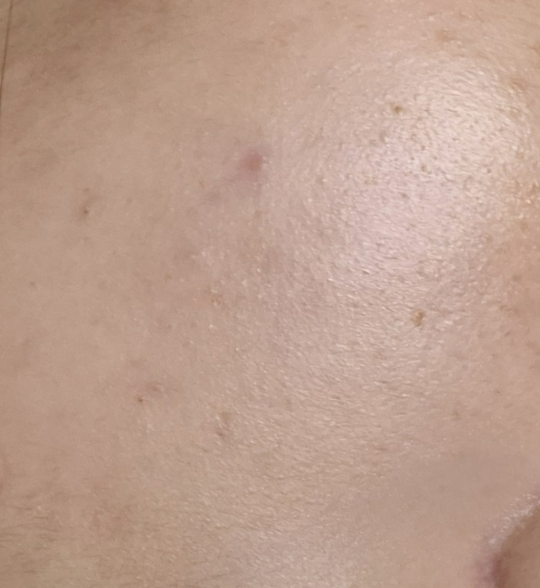 스킨앤랩 (SKIN&LAB) 쓰리디 피디알엔 엑스 콜라겐 랩핑 마스크 review image