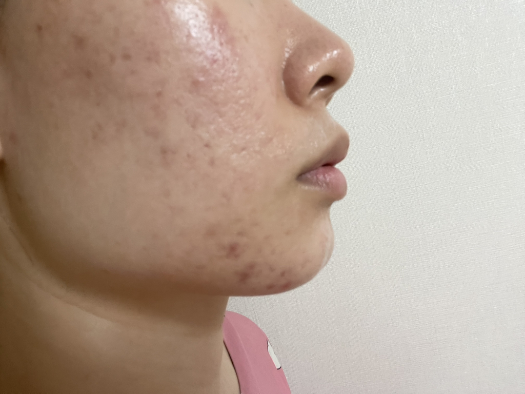 스킨앤랩 (SKIN&LAB) 쓰리디 피디알엔 엑스 콜라겐 랩핑 마스크 review image
