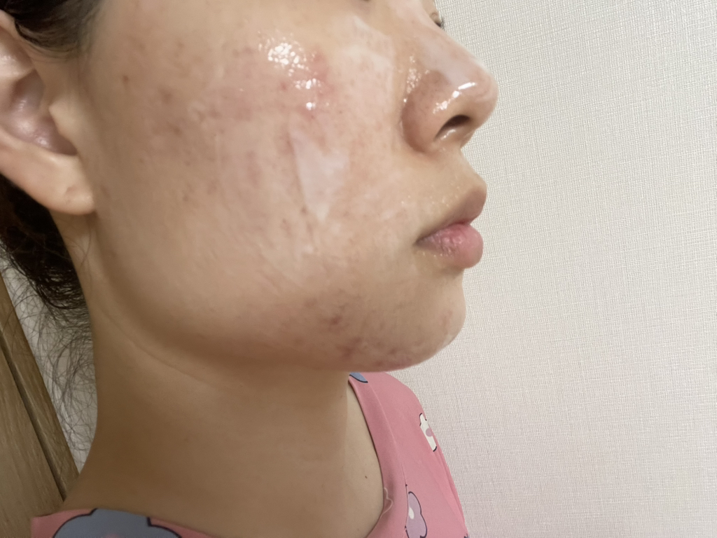 스킨앤랩 (SKIN&LAB) 쓰리디 피디알엔 엑스 콜라겐 랩핑 마스크 review image