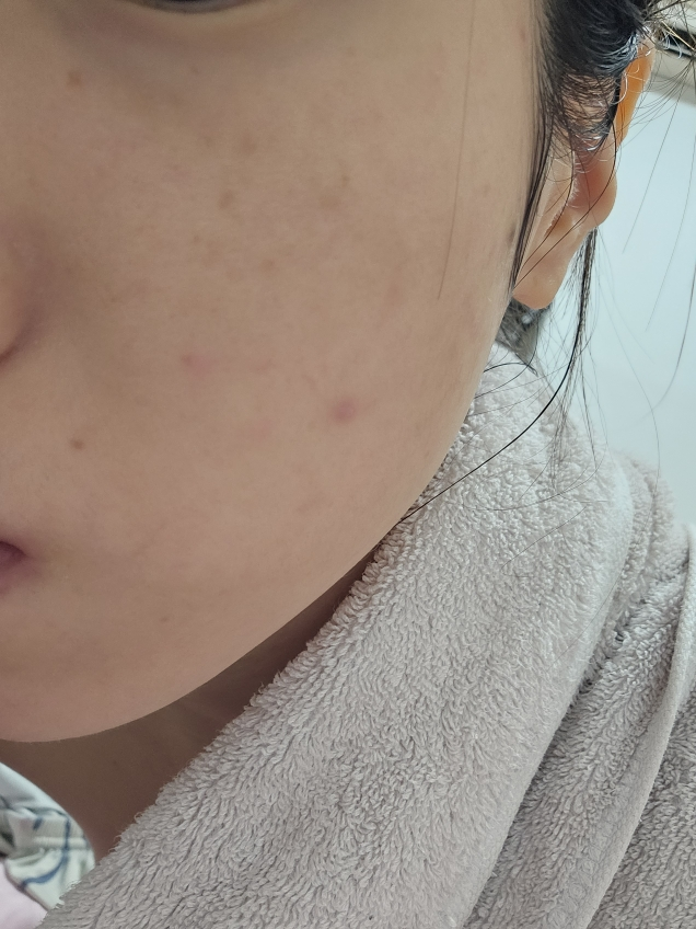 더레이디 (DERLADIE) 포어 더블 리커버리 바나티놀 크림 review image