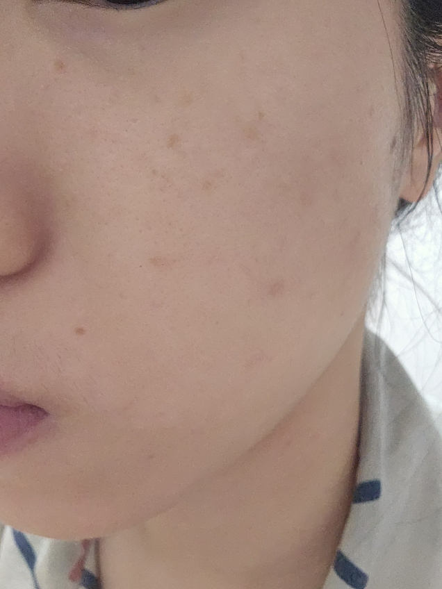 더레이디 (DERLADIE) 포어 더블 리커버리 바나티놀 크림 review image