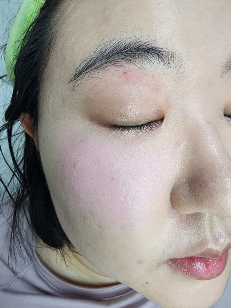 爱情光束脸颊炸弹 [02 #PureBeam]的真实用户使用照片