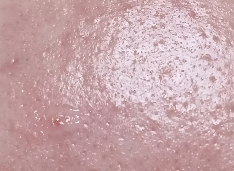 닥터지 (Dr.G) 레드 블레미쉬 클리어 히알 시카 수딩 세럼 review image