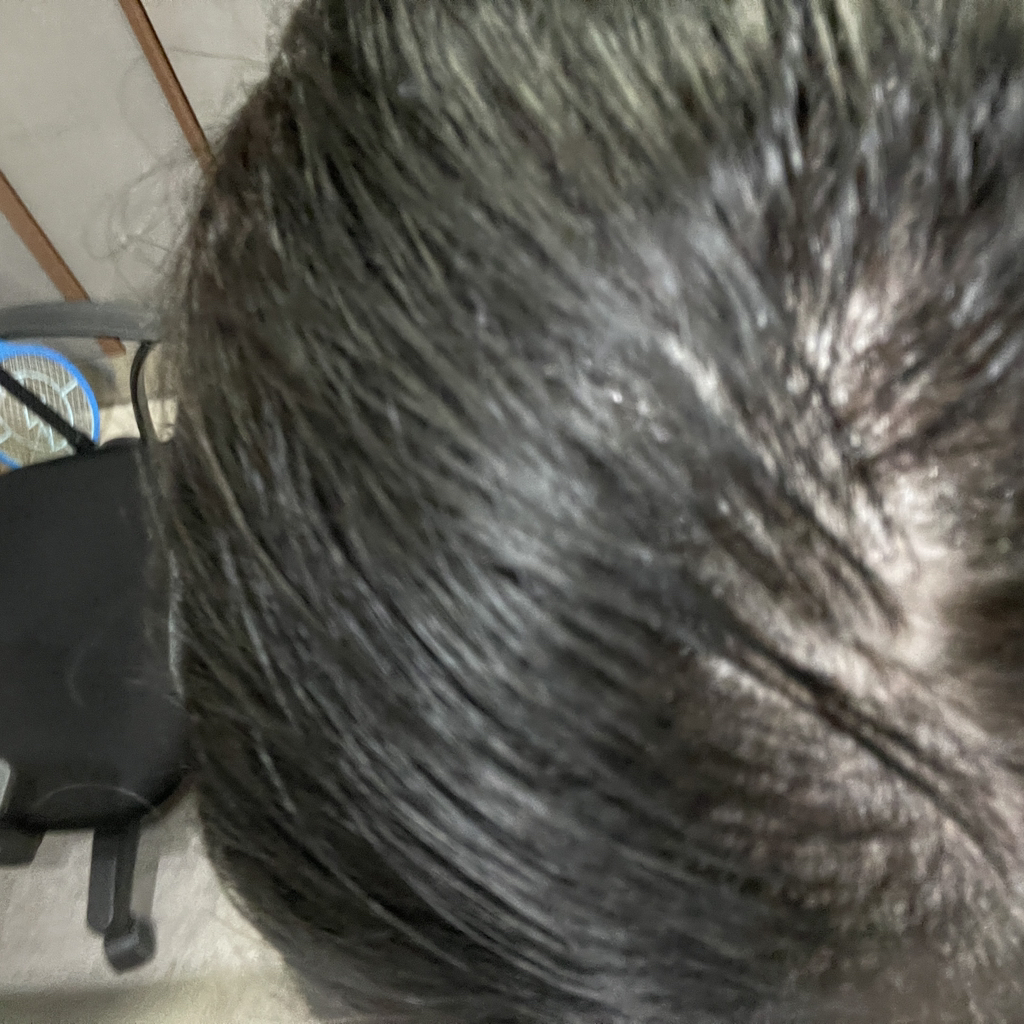 RGIII (알지쓰리) 레드진생 스칼프 토닉 review image