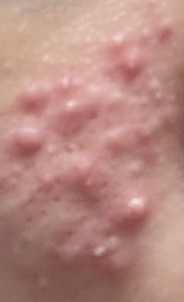 氨基酸洁面乳的真实用户使用照片