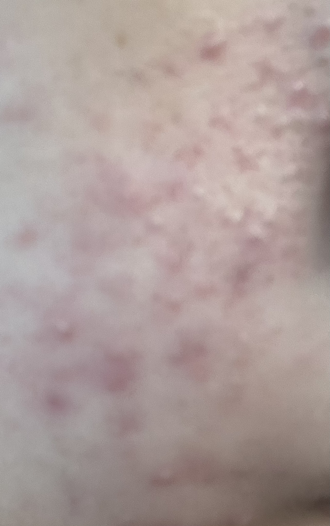 氨基酸洁面乳的真实用户使用照片