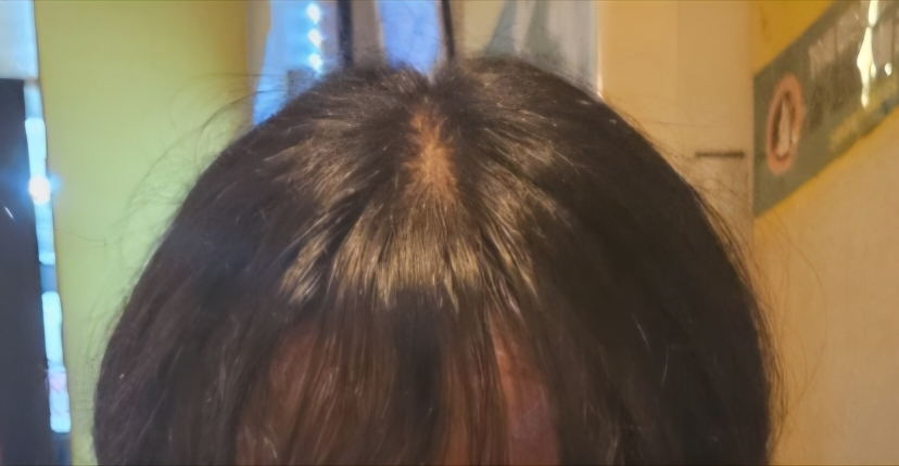 라보에이치 (LABO-H) 두피강화클리닉 앰플 토닉 review image